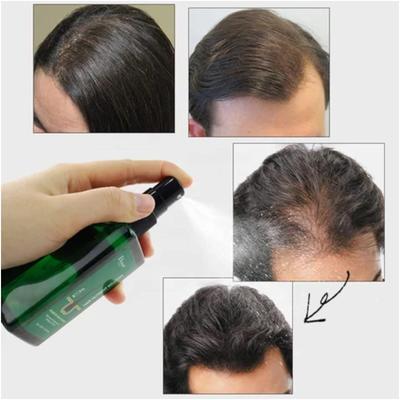 Hair Nutrients Solution Hair growth oil