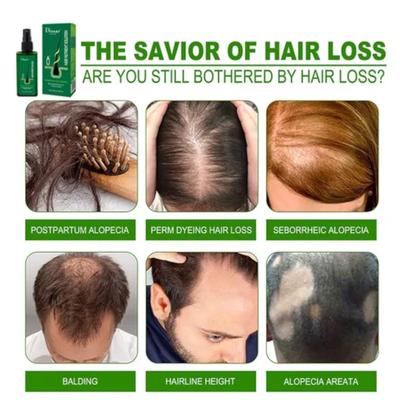 Hair Nutrients Solution Hair growth oil